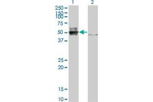 Western Blot analysis of EPSTI1 expression in transfected 293T cell line by EPSTI1 monoclonal antibody (M01), clone 2A8.