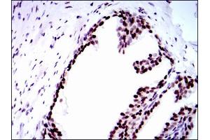 Image no. 5 for anti-Replication Protein A1, 70kDa (RPA1) antibody (ABIN1500741) (RPA1 Antikörper)