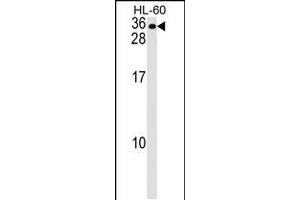 Western blot analysis in HL-60 cell line lysates (35ug/lane). (MS4A7 Antikörper  (AA 137-164))