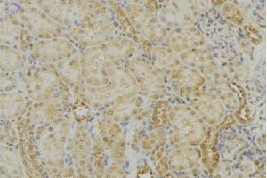 ABIN6279010 at 1/100 staining Mouse kidney tissue by IHC-P. (MRPS18B Antikörper  (Internal Region))