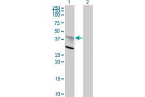 Western Blot analysis of CXCR4 expression in transfected 293T cell line by CXCR4 monoclonal antibody (M01), clone 2H5. (CXCR4 Antikörper  (AA 1-46))
