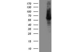 Western Blotting (WB) image for anti-IlvB (Bacterial Acetolactate Synthase)-Like (ILVBL) antibody (ABIN1498879) (ILVBL Antikörper)
