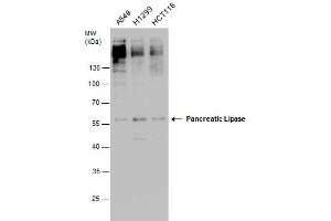 WB Image Pancreatic Lipase antibody detects Pancreatic Lipase protein by western blot analysis. (PNLIP Antikörper)