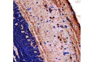 IHC analysis of LONP1 using anti-LONP1 antibody (AZA0A0R4IH79).