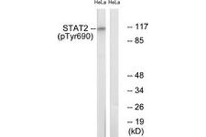 Western blot analysis of extracts from HeLa cells treated with IFN 2500U/ml 30', using STAT2 (Phospho-Tyr690) Antibody. (STAT2 Antikörper  (pTyr690))