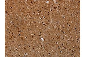 The image on the left is immunohistochemistry of paraffin-embedded Human brain tissue using ABIN7191558(MYBBP1A Antibody) at dilution 1/40, on the right is treated with synthetic peptide. (MYBBP1A Antikörper)