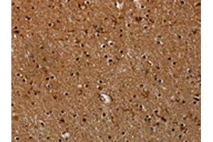 The image on the left is immunohistochemistry of paraffin-embedded Human brain tissue using ABIN7191558(MYBBP1A Antibody) at dilution 1/40, on the right is treated with synthetic peptide.