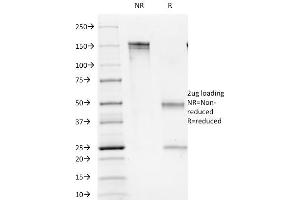 SDS-PAGE Analysis Purified CD1b Mouse Monoclonal Antibody (100-1A5). (CD1b Antikörper)