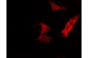 ABIN6274405 staining HepG2 by IF/ICC. (MARK2 Antikörper  (Internal Region))