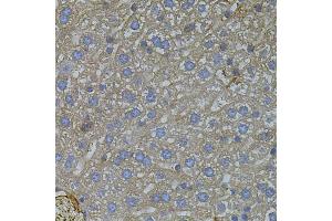Immunohistochemistry of paraffin-embedded mouse liver using VEGFC antibody (ABIN5971381) (40x lens). (VEGFC Antikörper)