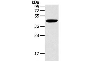 Western Blot analysis of Hela cell using RAD51 Polyclonal Antibody at dilution of 1:200 (RAD51 Antikörper)