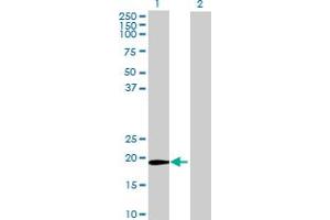 Western Blot analysis of ZFAND1 expression in transfected 293T cell line by ZFAND1 MaxPab polyclonal antibody. (ZFAND1 Antikörper  (AA 1-161))