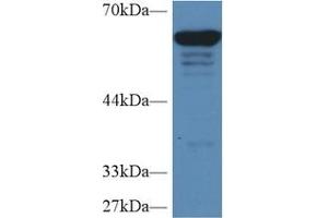 Detection of PKM2 in Human HepG2 cell lysate using Polyclonal Antibody to Pyruvate kinase isozymes M2 (PKM2) (PKM2 Antikörper  (AA 141-248))