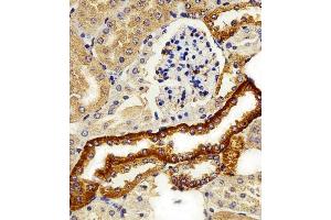 Immunohistochemical analysis of paraffin-embedded M. (FXYD6 Antikörper  (C-Term))