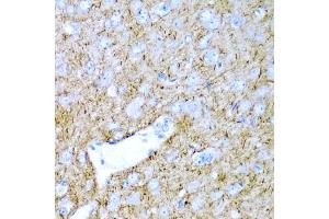Immunohistochemistry of paraffin-embedded rat brain using PTGDS antibody. (PTGDS Antikörper)
