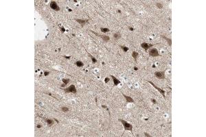 Immunohistochemical staining of human cerebral cortex with FBXO44 polyclonal antibody  shows strong nuclear and cytoplasmic positivity in neuronal cells at 1:200-1:500 dilution. (FBXO44 Antikörper)