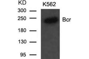 Image no. 2 for anti-Breakpoint Cluster Region (BCR) (Tyr177) antibody (ABIN197420) (BCR Antikörper  (Tyr177))