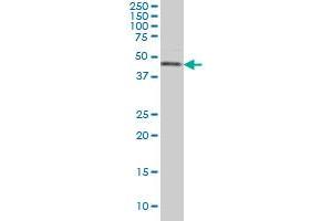 CSNK1G1 monoclonal antibody (M02), clone 2E10 Western Blot analysis of CSNK1G1 expression in Hela S3 NE . (CSNK1G1 Antikörper  (AA 293-393))