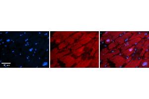 Rabbit Anti-HDAC6 Antibody    Formalin Fixed Paraffin Embedded Tissue: Human Adult heart  Observed Staining: Cytoplasmic,Nuclear Primary Antibody Concentration: 1:600 Secondary Antibody: Donkey anti-Rabbit-Cy2/3 Secondary Antibody Concentration: 1:200 Magnification: 20X Exposure Time: 0.