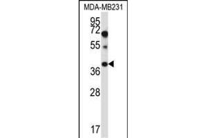 PTPLA Antibody (N-term) (ABIN657409 and ABIN2846449) western blot analysis in MDA-M cell line lysates (35 μg/lane).