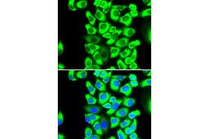 Immunofluorescence analysis of MCF-7 cells using RPS3A antibody (ABIN5973489). (RPS3A Antikörper)
