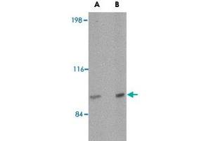 Western blot analysis of SATB2 in mouse brain tissue lysate with SATB2 polyclonal antibody  at (A) 2 and (B) 4 ug/mL . (SATB2 Antikörper  (N-Term))
