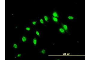 Immunofluorescence of monoclonal antibody to C17orf75 on HeLa cell. (C17orf75 Antikörper  (AA 1-396))