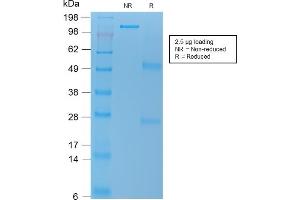 SDS-PAGE Analysis Purified VEGI Mouse Recombinant Monoclonal Antibody (rVEGI /1283). (Rekombinanter TNFSF15 Antikörper)