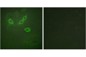 Immunofluorescence analysis of HeLa cells, using TUSC5 antibody. (TUSC5 Antikörper  (N-Term))