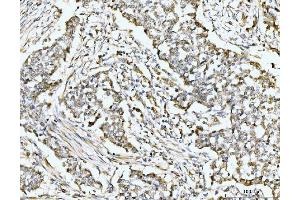 IHC analysis of MSK2/RSK-B/RPS6KA4 using anti-MSK2/RSK-B/RPS6KA4 antibody (ABIN7601238).