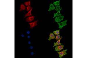 ABIN6262505 and ABIN6269199 staining HepG2 cells by IF/ICC.