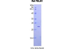 SDS-PAGE of Protein Standard from the Kit (Highly purified E. (Fibulin 1 ELISA Kit)