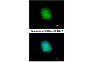 ICC/IF Image Immunofluorescence analysis of methanol-fixed A431, using Amisyn, antibody at 1:200 dilution.