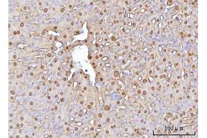 IHC analysis of FAA/FAH using anti-FAA/FAH antibody (ABIN7599291).