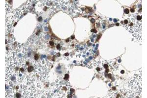 ABIN6267684 at 1/100 staining human Bone marrow tissue sections by IHC-P.