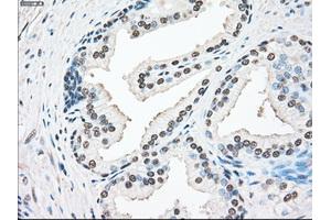 Immunohistochemical staining of paraffin-embedded lung tissue using anti-SSBmouse monoclonal antibody. (SSB Antikörper)