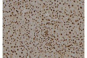 Immunohistochemistry (IHC) image for anti-SWI/SNF Related, Matrix Associated, Actin Dependent Regulator of Chromatin, Subfamily E, Member 1 (SMARCE1) (C-Term) antibody (ABIN6265182)