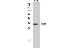 Western Blotting (WB) image for anti-Forkhead Box E1 (Thyroid Transcription Factor 2) (FOXE1) (N-Term) antibody (ABIN3184656) (FOXE1 Antikörper  (N-Term))