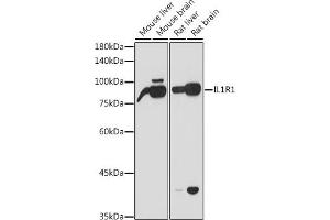 Western blot analysis of extracts of various cell lines, using IL1R1 antibody (ABIN6134083, ABIN6142341, ABIN6142342 and ABIN6221393) at 1:1000 dilution.