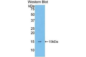 Western Blotting (WB) image for anti-Thymic Stromal Lymphopoietin (TSLP) (AA 75-196) antibody (ABIN1174486) (Thymic Stromal Lymphopoietin Antikörper  (AA 75-196))