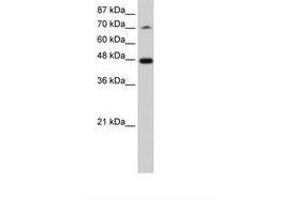 Image no. 2 for anti-Splicing Factor 3b, Subunit 4, 49kDa (SF3B4) (N-Term) antibody (ABIN202492) (SF3B4 Antikörper  (N-Term))