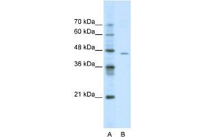 WB Suggested Anti-ACCN4 Antibody Titration:  0. (ACCN4 Antikörper  (N-Term))