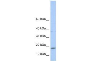 Western Blot showing MAX antibody used at a concentration of 1-2 ug/ml to detect its target protein. (MAX Antikörper  (N-Term))