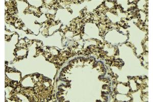 ABIN6268997 at 1/100 staining Mouse lung tissue by IHC-P.
