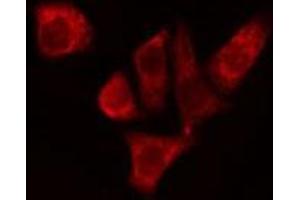 ABIN6274956 staining Hela cells by IF/ICC. (CA1 Antikörper  (Internal Region))