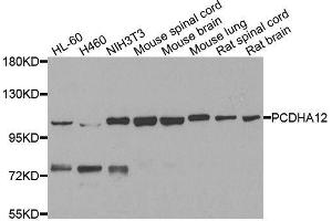 Western blot analysis of extracts of various cell lines, using PCDHA12 antibody. (PCDHA12 Antikörper  (AA 713-792))