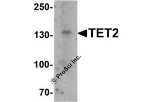 Western Blotting (WB) image for anti-Tet Methylcytosine Dioxygenase 2 (TET2) (N-Term) antibody (ABIN1031611) (TET2 Antikörper  (N-Term))