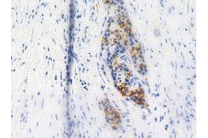 anti-Lipase, Hormone-Sensitive (LIPE) (pSer552) antibody