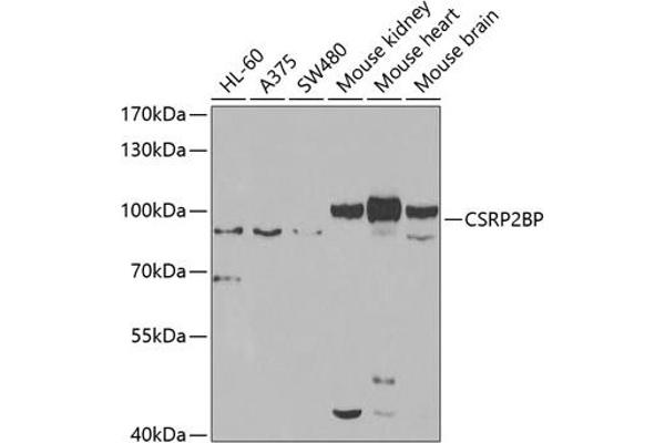 CSRP2BP Antikörper  (AA 523-782)