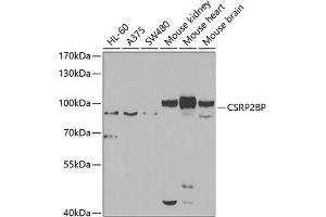 Western blot analysis of extracts of various cell lines, using CSRP2BP antibody (ABIN6127664, ABIN6139138, ABIN6139139 and ABIN6223242) at 1:1000 dilution.